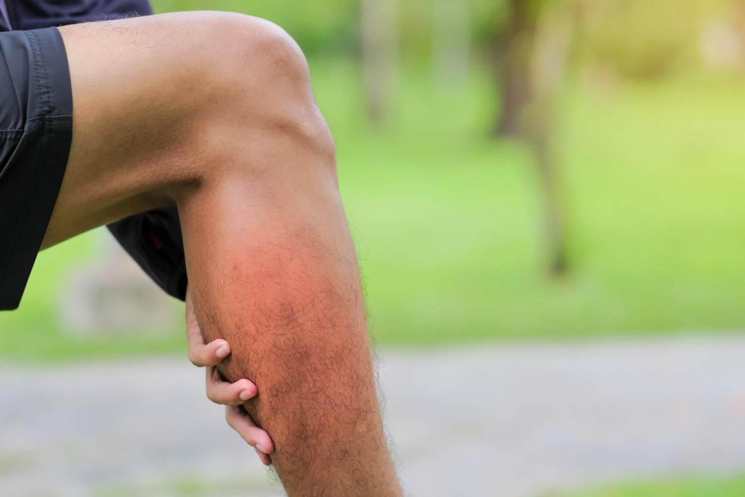 Insect Bite Allergy: Symptoms, Causes, and Treatment