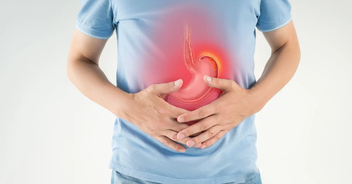 What Relieves Bloating Fast