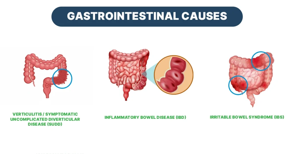 Medical diagram illustrating PID, cysts, torsion, and endometriosis as causes.