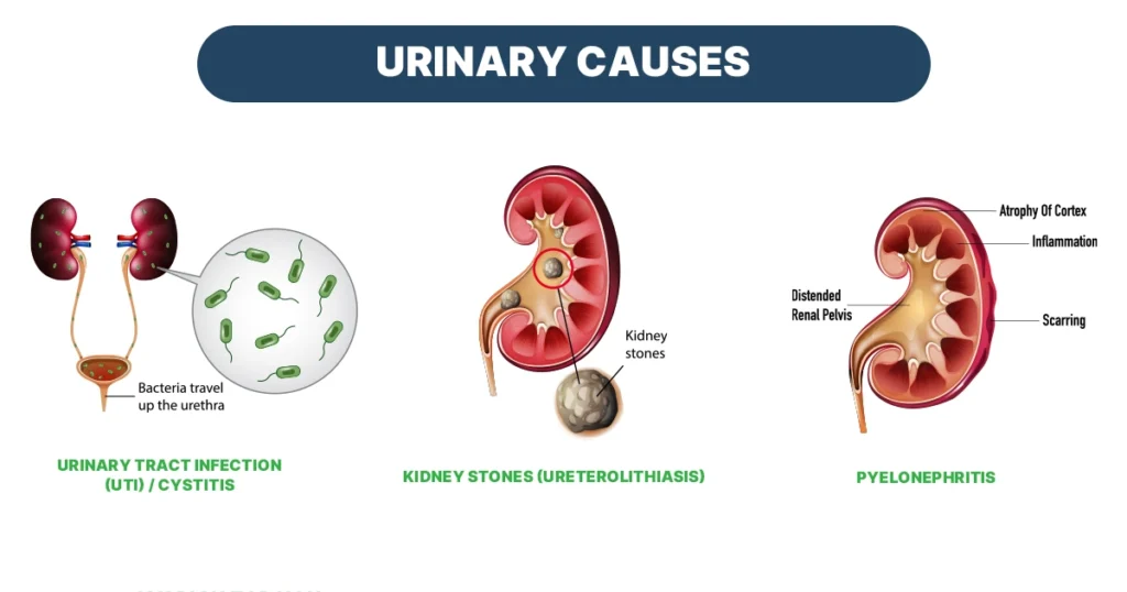 Diagram shows common urinary causes of pain, including UTI and kidney stones.