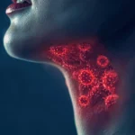 Strep throat infection causing inflamed, contagious throat