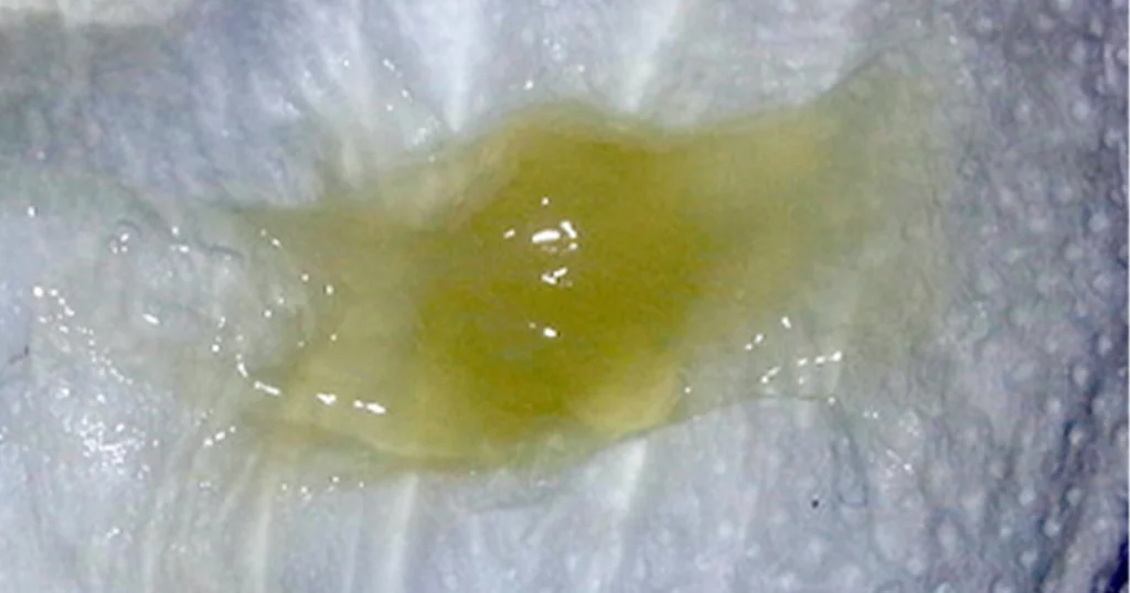 Does green mucus mean infection present.