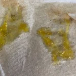 Yellow mucus discharge on tissue showing thick phlegm.