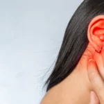 Red, inflamed ear indicating possible ear infection.