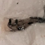 Black mucus sample on tissue paper.