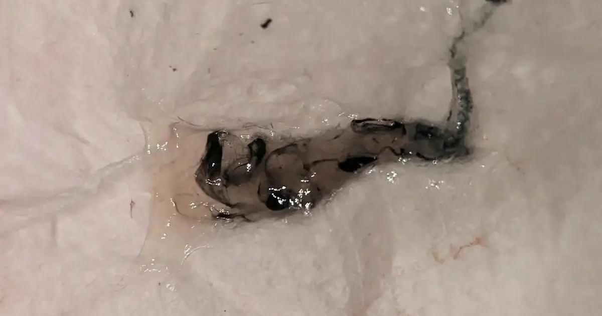 Why Is My Mucus Black