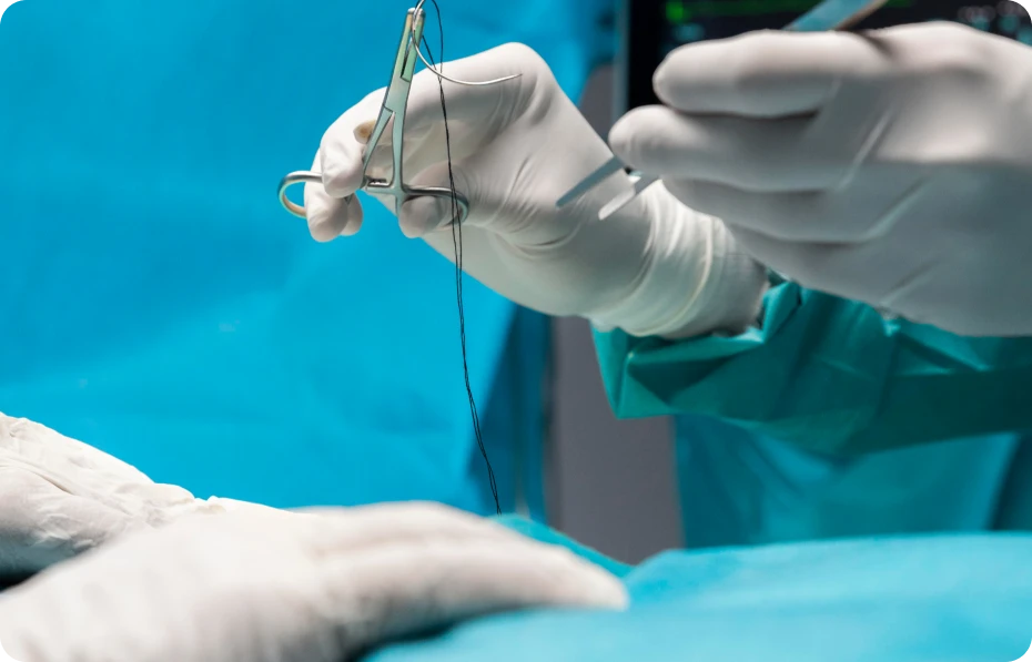 Surgeon’s gloved hands holding a surgical needle and thread during an operation