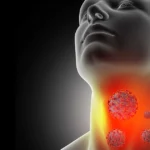 Sore throat with inflamed tonsils highlighted in the neck area.