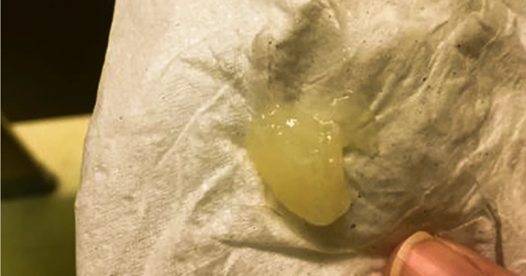 Mucus with a yellowish tint on tissue paper.