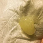 Mucus with a yellowish tint on tissue paper.