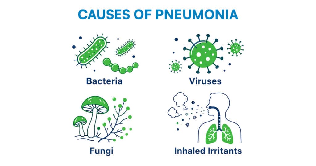 Infographic showing biological and environmental pneumonia causes.