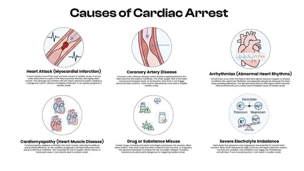 Infographic on causes of cardiac arrest including heart attack, coronary artery disease, arrhythmias, cardiomyopathy, substance misuse, and electrolyte imbalance.