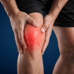 Swollen painful knee with red inflammation highlight.