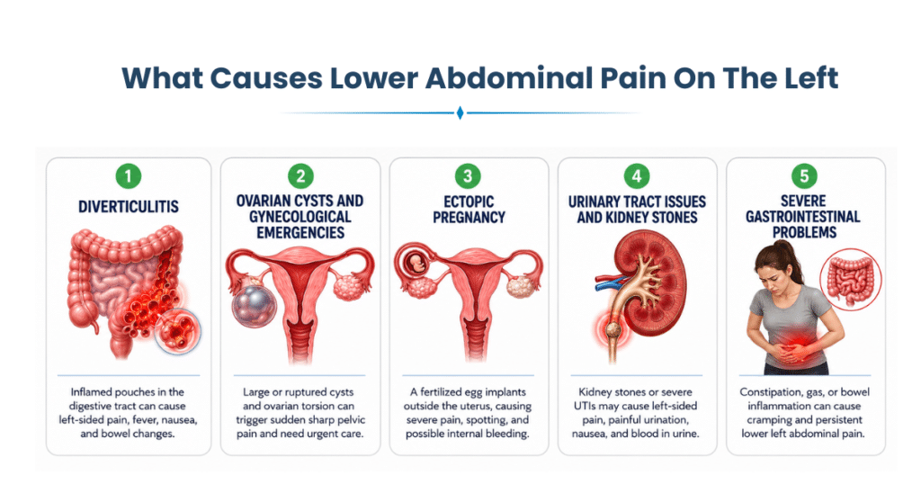 Infographic showing causes of lower left abdominal pain.