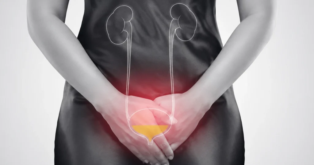 Woman experiencing bladder pain.