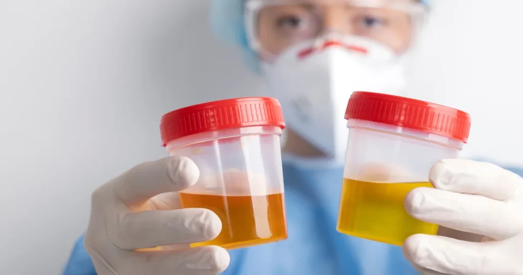 Lab doctor comparing two urine samples