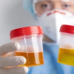 Lab doctor comparing two urine samples