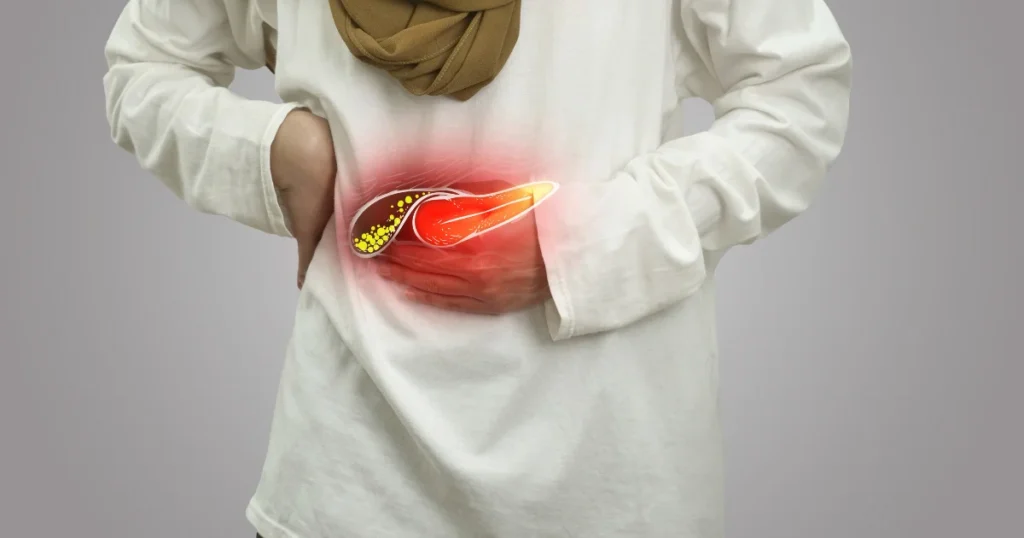 Highlighted gallbladder showing what causes gallstones