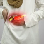Highlighted gallbladder showing what causes gallstones